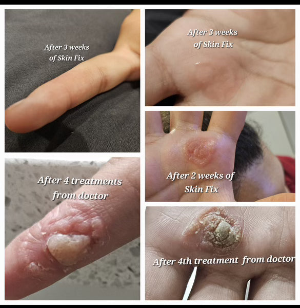 Skin Fix